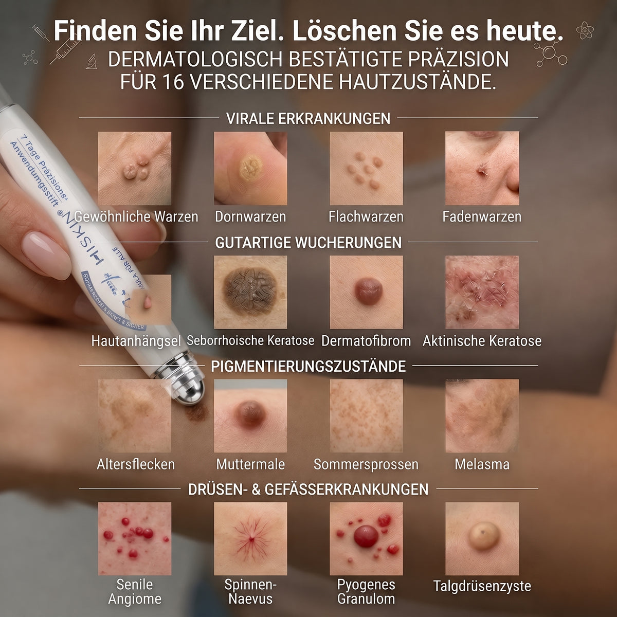 𝐇𝐈𝐒𝐊𝐈𝐍®👩‍⚕️ 7-Tage Skin Tag & Spot Eraser – Sanfte, präzise Pflege für sichtbare Hautunregelmäßigkeiten mit Roll-on-Applikator