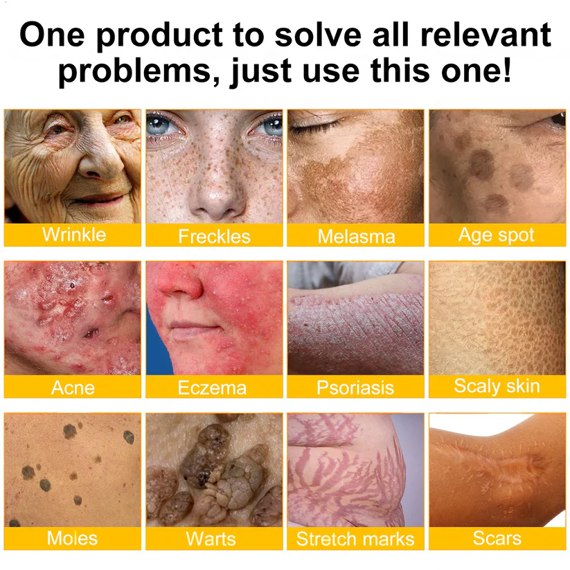 Hergestellt & versendet aus Deutschland 🇩🇪 Solaroza® Bienengift-Regenerationscreme. Starkes Anti-Aging. 100% Bienenfreundlich. ⏰ NUR NOCH HEUTE: 80% RABATT 💖