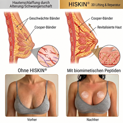 ❤️ Breast Firming👩‍⚕️ & Fuller-Looking Curves HISKIN® — Advanced Nano-Microneedle Patch for Targeted Care -1