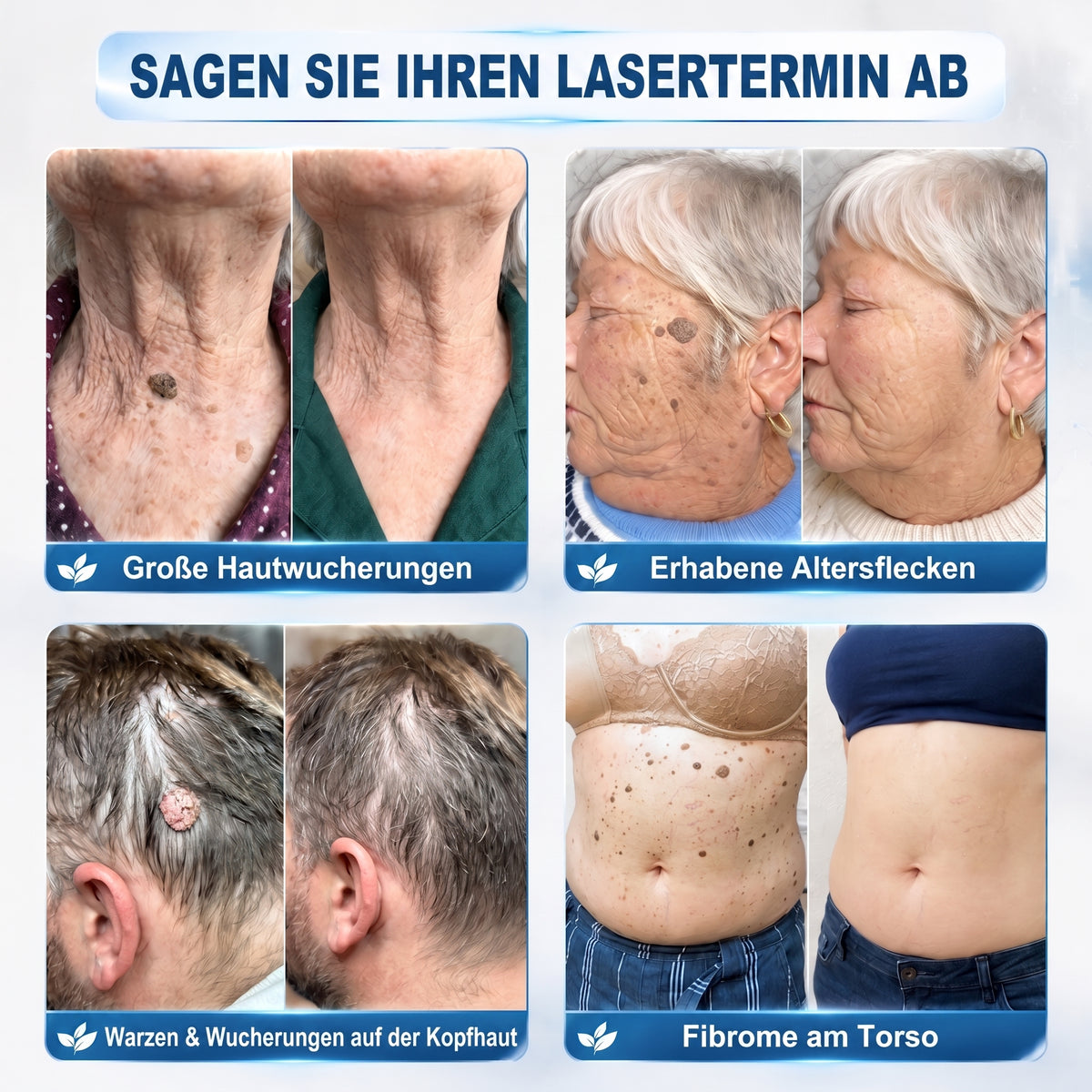 𝐇𝐈𝐒𝐊𝐈𝐍®👩‍⚕️ 7-Tage Skin Tag & Spot Eraser – Sanfte, präzise Pflege für sichtbare Hautunregelmäßigkeiten mit Roll-on-Applikator
