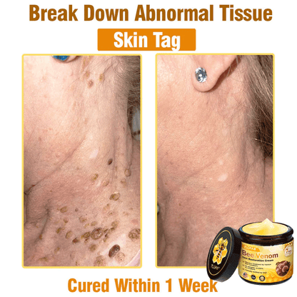 Hergestellt & versendet aus Deutschland 🇩🇪 Solaroza® Bienengift-Regenerationscreme. Starkes Anti-Aging. 100% Bienenfreundlich. ⏰ NUR NOCH HEUTE: 80% RABATT 💖
