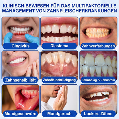𝐇𝐈𝐒𝐊𝐈𝐍® 👩‍⚕️🇩🇪🏅🦷🛡️ GumRevive Parodontal-Reparaturgel