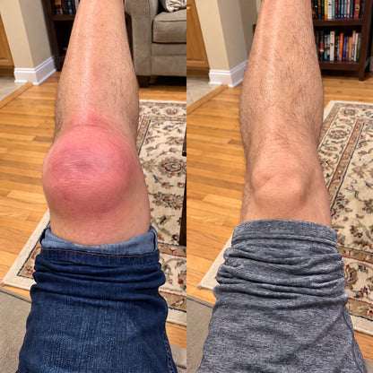 🧑‍⚕️💪New & Upgraded: Solaroza® Totale Verligting — Targeted relief for pain and tension. Visibly calms nerves, supports muscle recovery, and helps restore mobility.