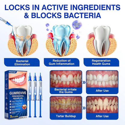𝐇𝐈𝐒𝐊𝐈𝐍® 👩‍⚕️🇩🇪🏅🦷🛡️ GumRevive Parodontal-Reparaturgel