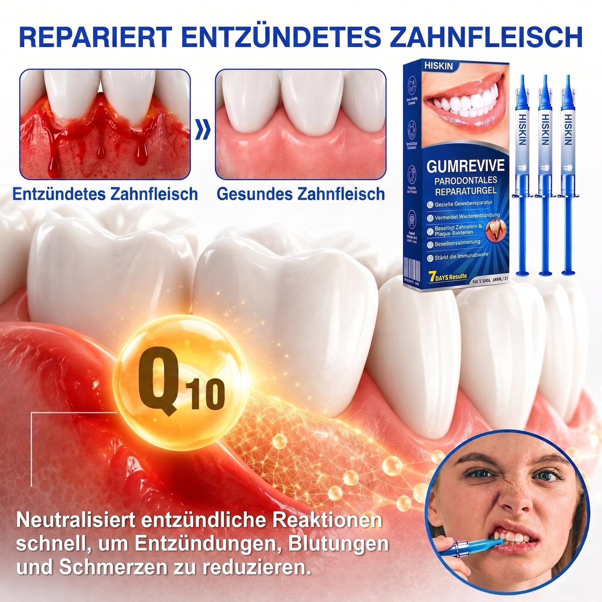 𝐇𝐈𝐒𝐊𝐈𝐍® 👩‍⚕️🇩🇪🏅🦷🛡️ GumRevive Parodontal-Reparaturgel