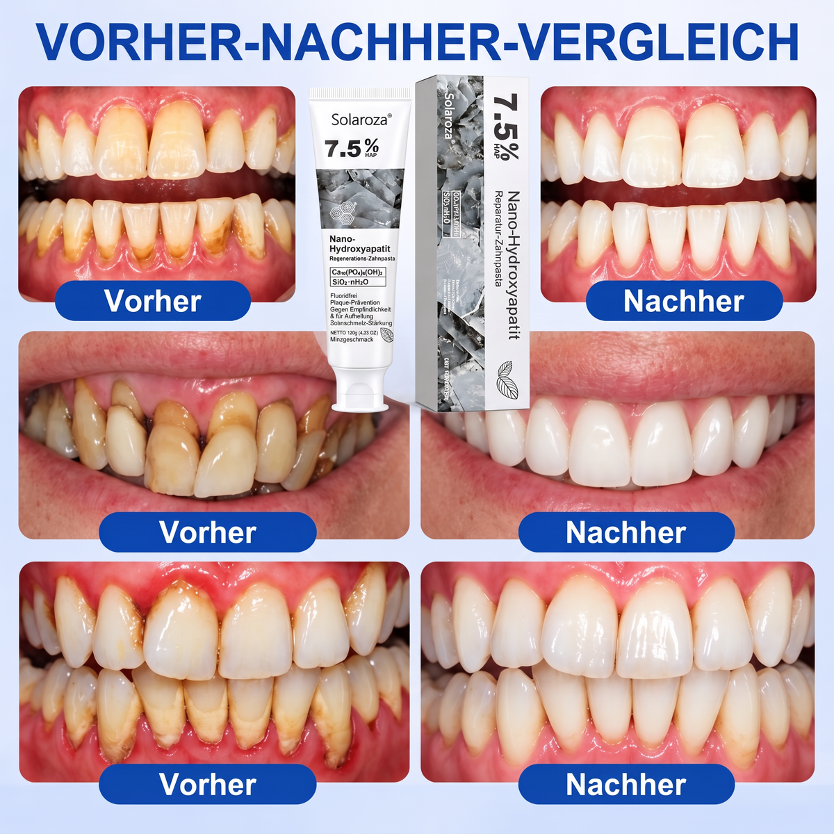 🧑‍⚕️🦷❄️Solaroza® Gum Revive periodontal repair gel