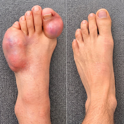 🧑‍⚕️💪New & Upgraded: Solaroza® Totale Verligting — Targeted relief for pain and tension. Visibly calms nerves, supports muscle recovery, and helps restore mobility.